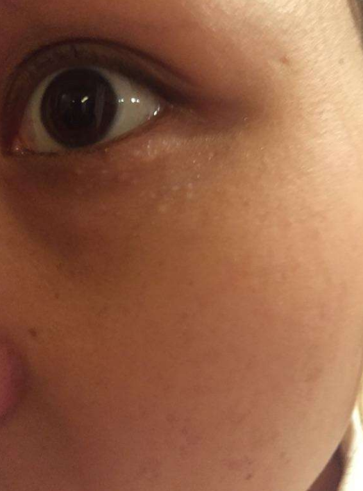 早晚抹点它,淡化眼袋,脂肪粒都不长了