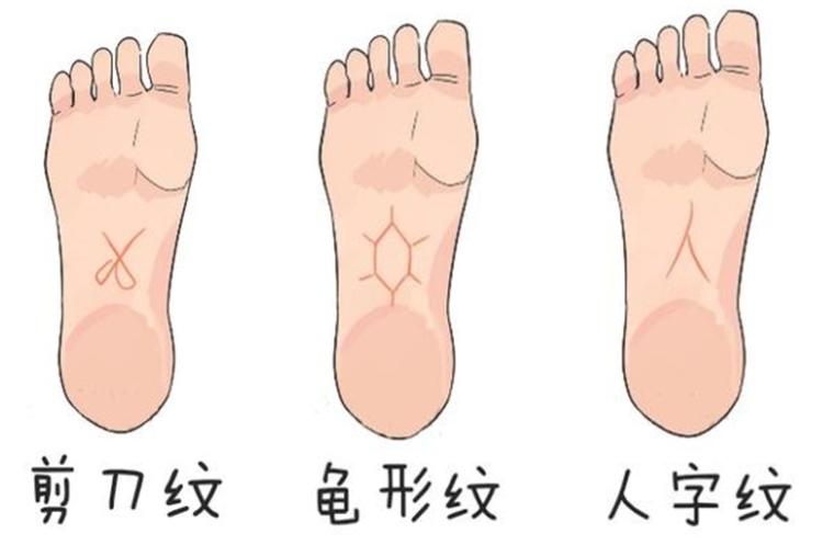 富贵脚纹图片大全图片