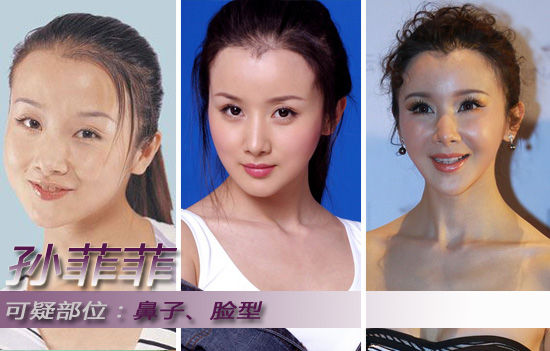 娱乐圈整容失败的4大女明星,图2惨不忍睹,最后一位好可惜