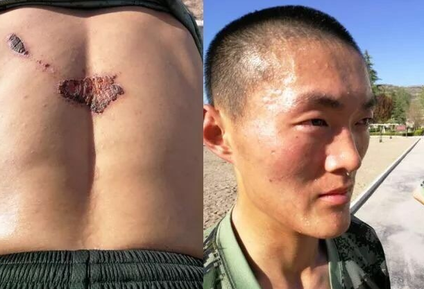 有一种美,叫做军人的伤疤,90后士兵的青春勋章