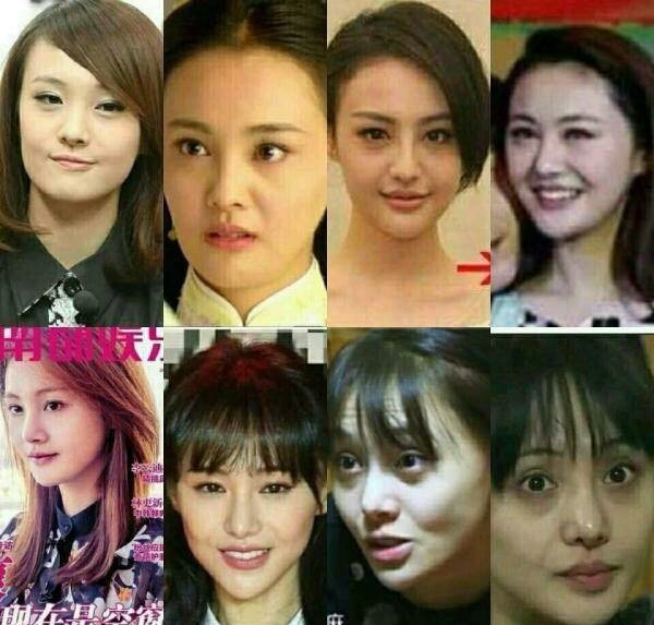 郑爽整容从而面部僵硬,哪些女星踏上这条不归路?