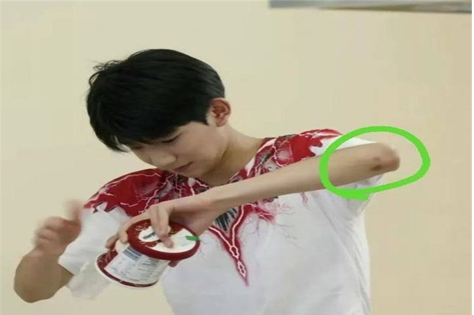 tfboys三兄弟,王源手背受伤,王俊凯手腕受伤,心疼易烊千玺!
