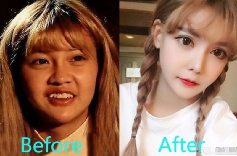 她19岁流产后又被男友抛弃,疯狂整容33次后再次迷失自己!