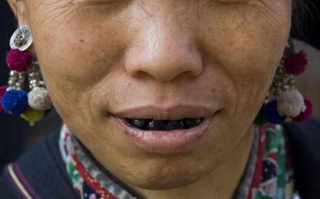 越南的女人是牙齿越黑越美,喜欢吃槟榔,提亲不要钱,只需要槟榔
