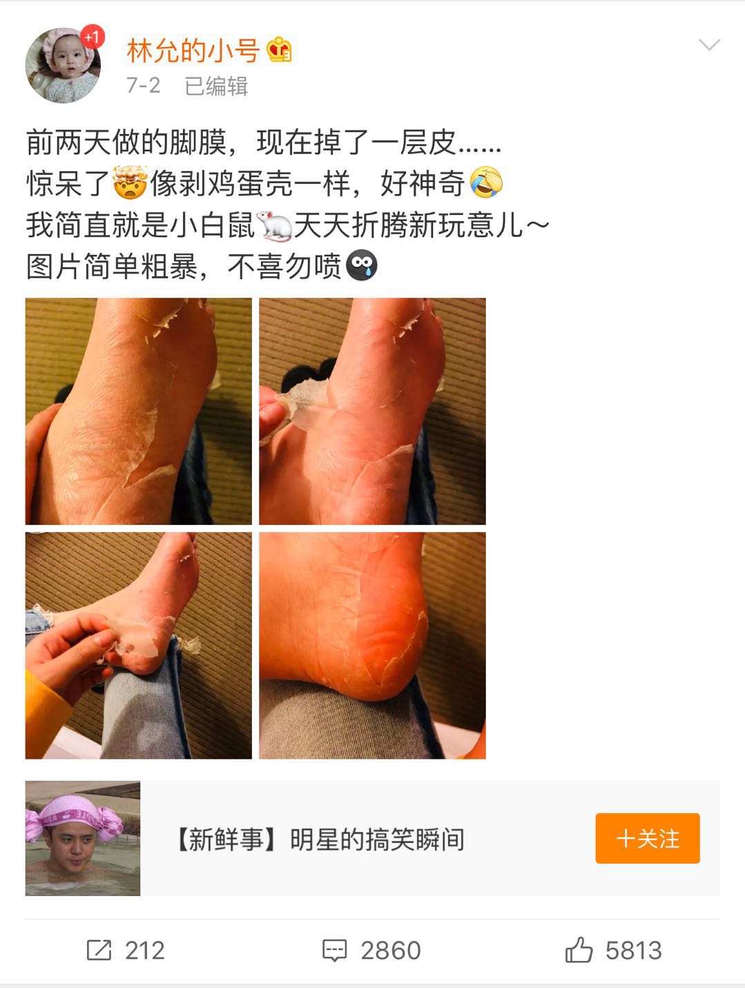 林允公开撕脚皮,网友评论不顾形象,她竟然敢这样回答?