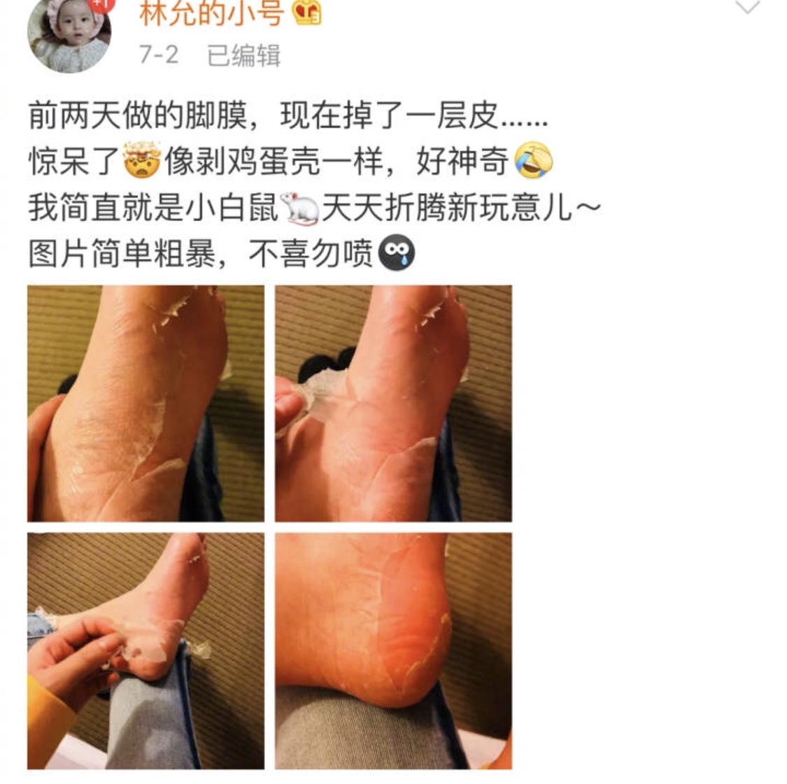 林允直播撕腳皮,這是賣耿直人設?簡直讓人噁心到吃不下飯