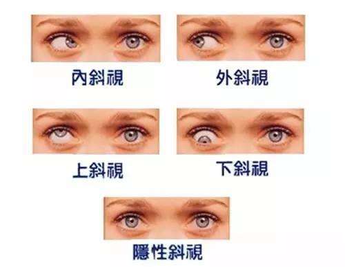 小孩儿眼睛斜视弱视近视屈光不正去北京哪个医院看病看哪个科室