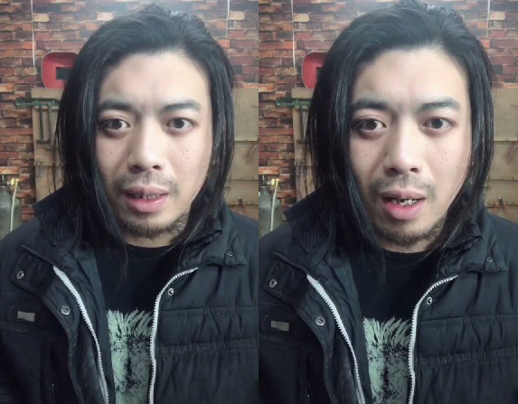 脑瓜崩把人脑门弹个大包,"快手爱迪生"称那不是真的,是p图?