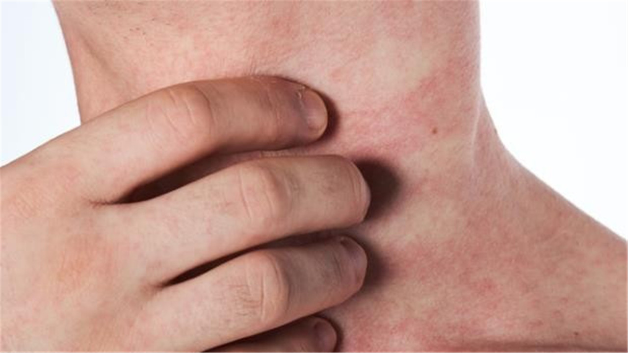 女大学生身患艾滋病:这三件事最好别做!最后一点很多女生喜欢!