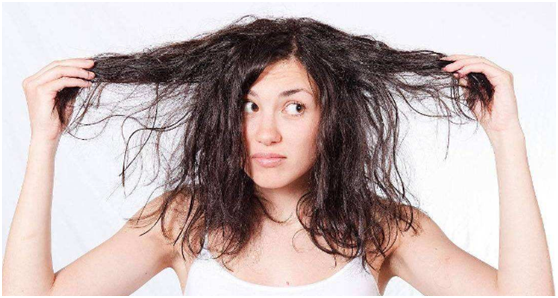 从仙女到"秃瓢",你的头发天天掉,"秃顶"还有几秒到达战场?