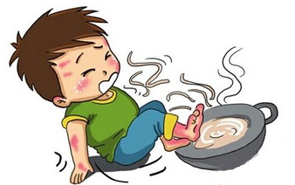 用生姜汁湿敷治疗水火烫伤特效