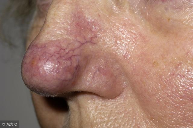 肝病早期不易察觉?这3个信号,在提醒你肝病快来了!