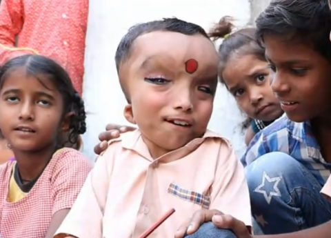 印度6岁男童长相奇特,被当地人奉为象头神,每日接受朝拜!