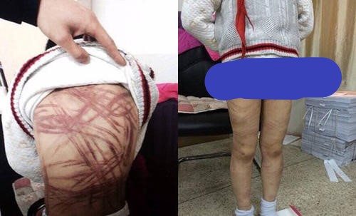 女儿半夜高烧不退,迷糊中一直念叨"铅笔盒",妈妈打开情绪失控