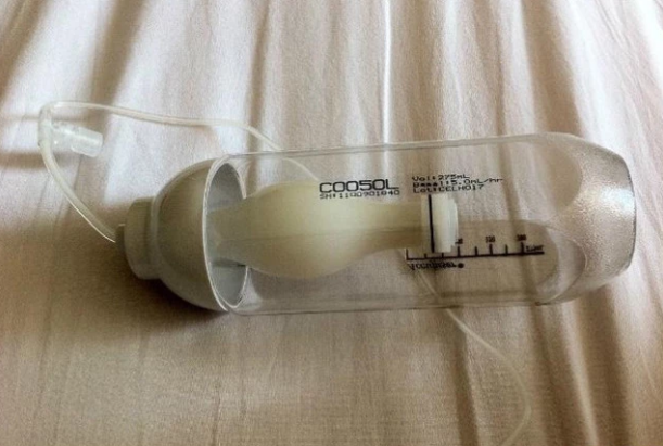 剖腹产用的止痛泵图片图片