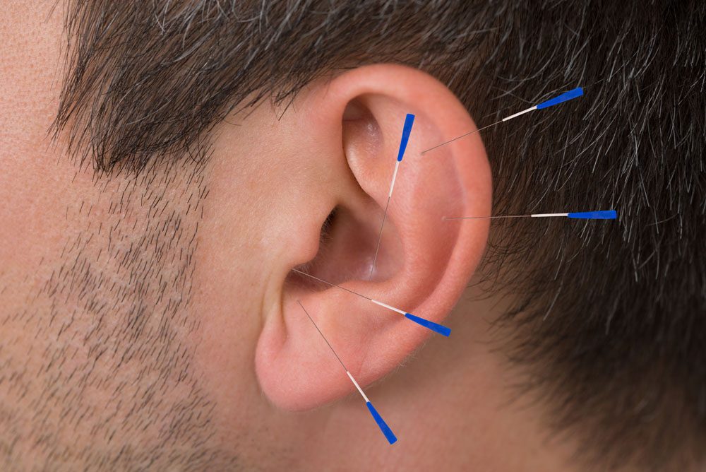 耳朵针灸图图片