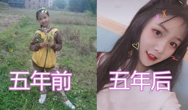 五年前vs五年后,岁月是把整容刀,看到图四,网友:哥哥网恋吗