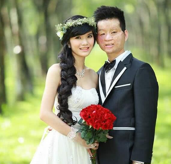 20岁越南美女嫁给丑男,身边流言不断无奈搬去国外,如今生活幸福