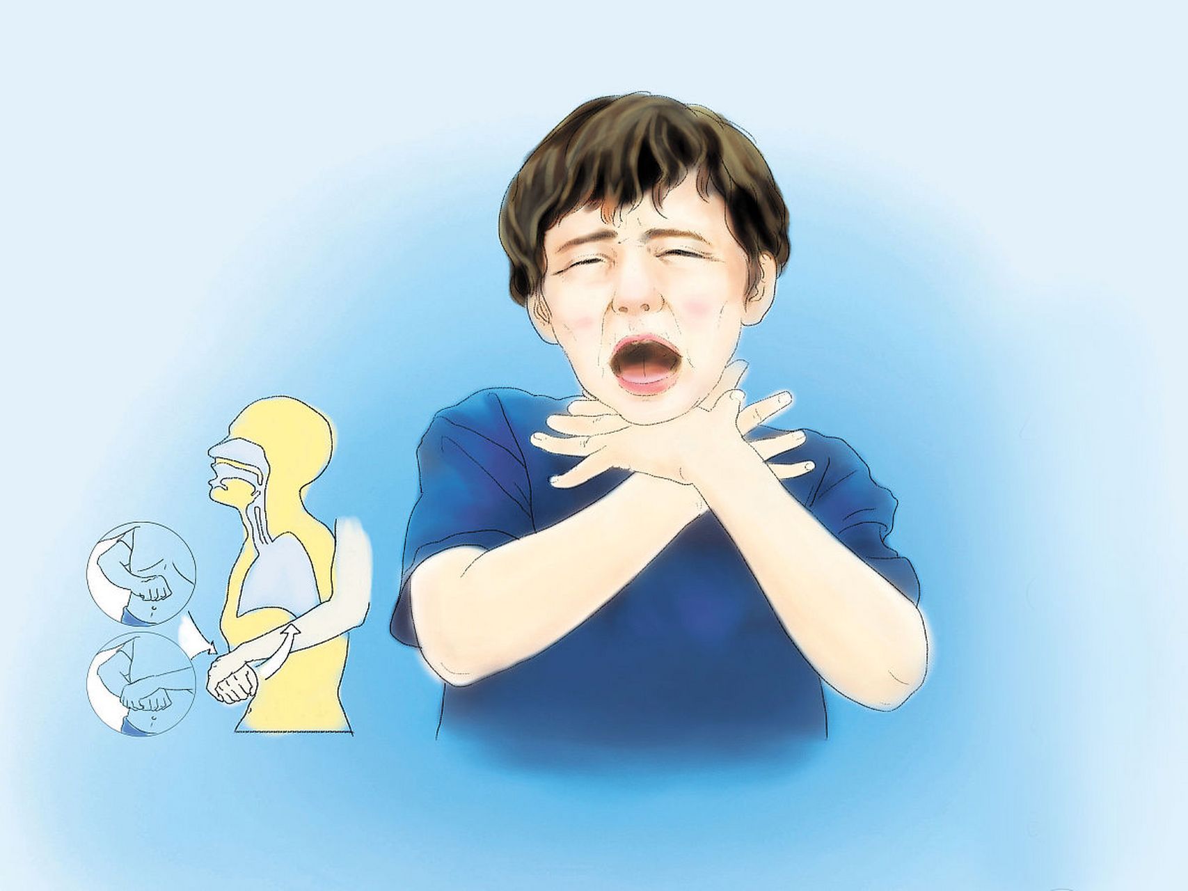 以下是吞咽困难可能的原因: 喉炎和咽炎:喉咙部位感染或发炎可能会