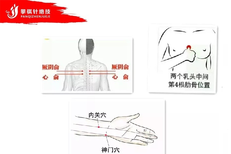 怎么就得了心肌缺血?