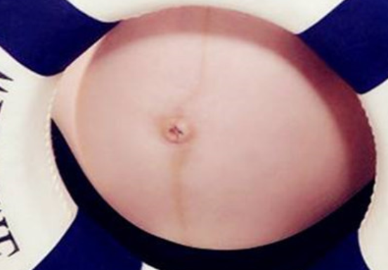 肚脐女孩妊娠线图片