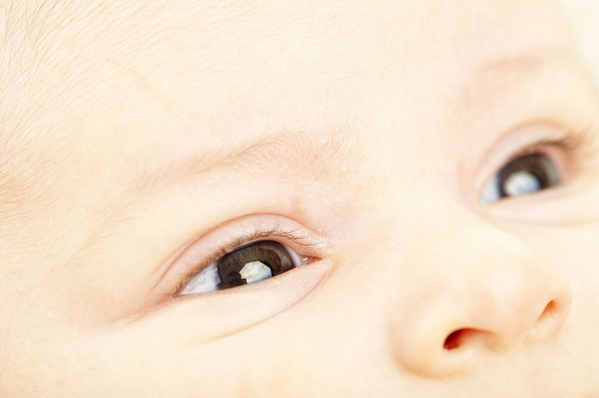 保持眼部清洁,观察症状变化是关键7215及时就医治