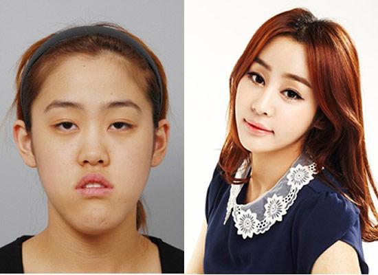 韩国丑女整容数次后变"女神",没得连亲妈都不认识了!