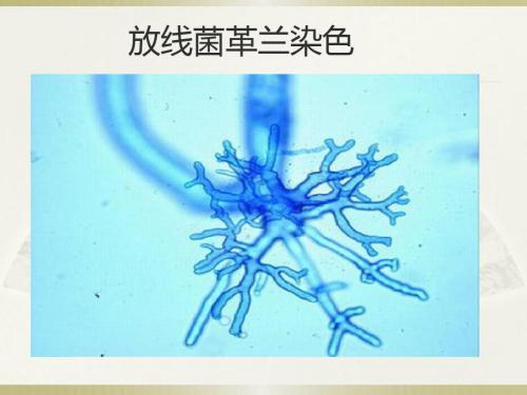 放线菌孢子丝图片