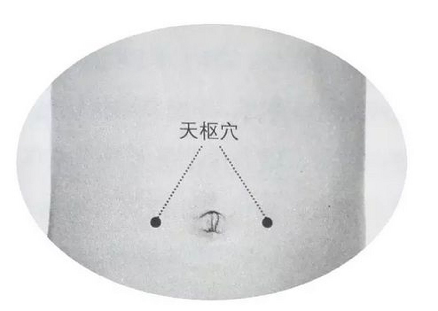 天枢穴 可增强胃功能 天枢是胃经上的一大要穴,位于肚脐旁2寸处胗