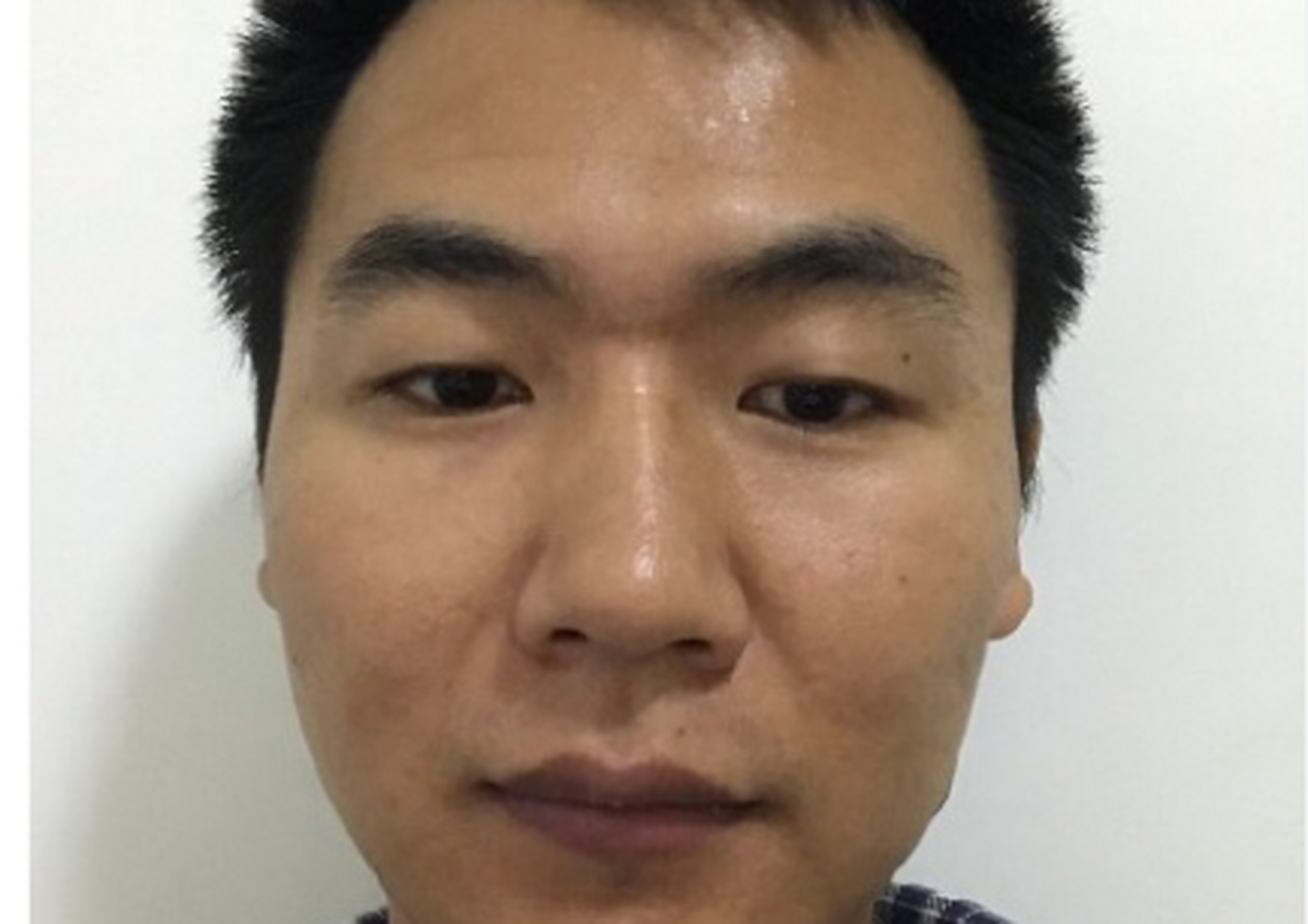 眉浓唇厚,内心重视感情,但是性格多冲动,山根折断,注定感情不顺,在