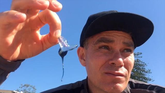 为挑战自己的痛感,近日,澳大利亚一男子将有毒的蓝瓶僧帽水母放到脚背