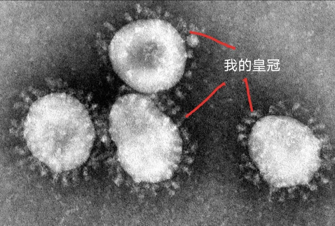 寇维病毒(covid-19)肺炎通俗解读