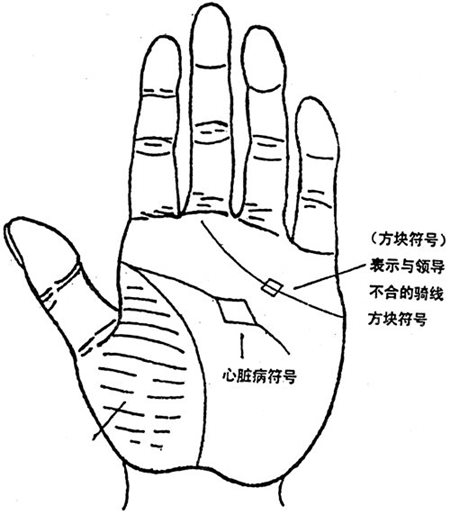 手相看爱人是单眼皮还是双眼皮