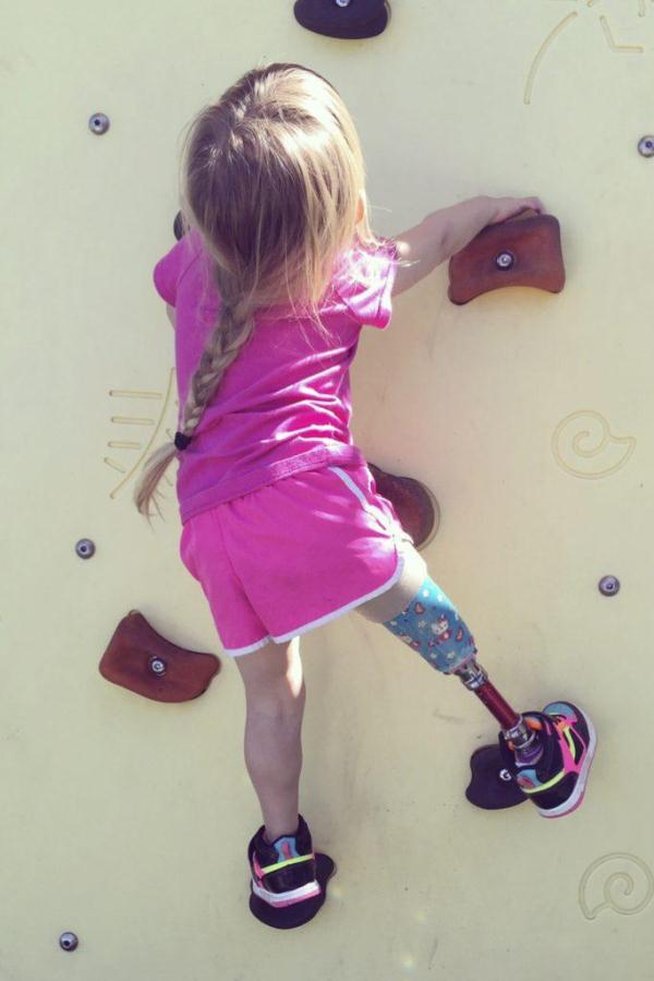 美国5岁小女孩笑对人生,戴假肢征服运动场成全能王