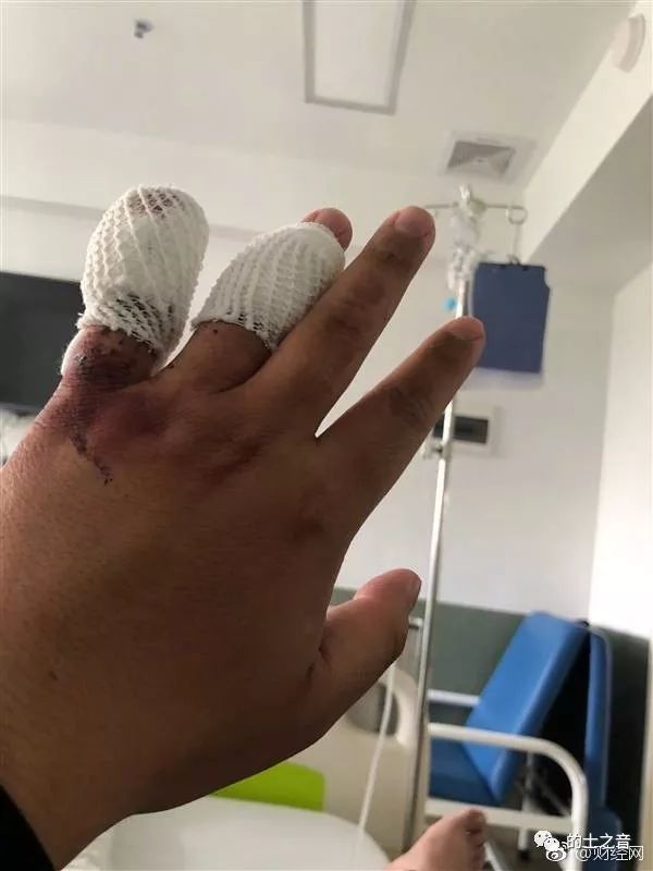 顺风车司机持刀砍断乘客手指!顺风车还能放心坐吗?