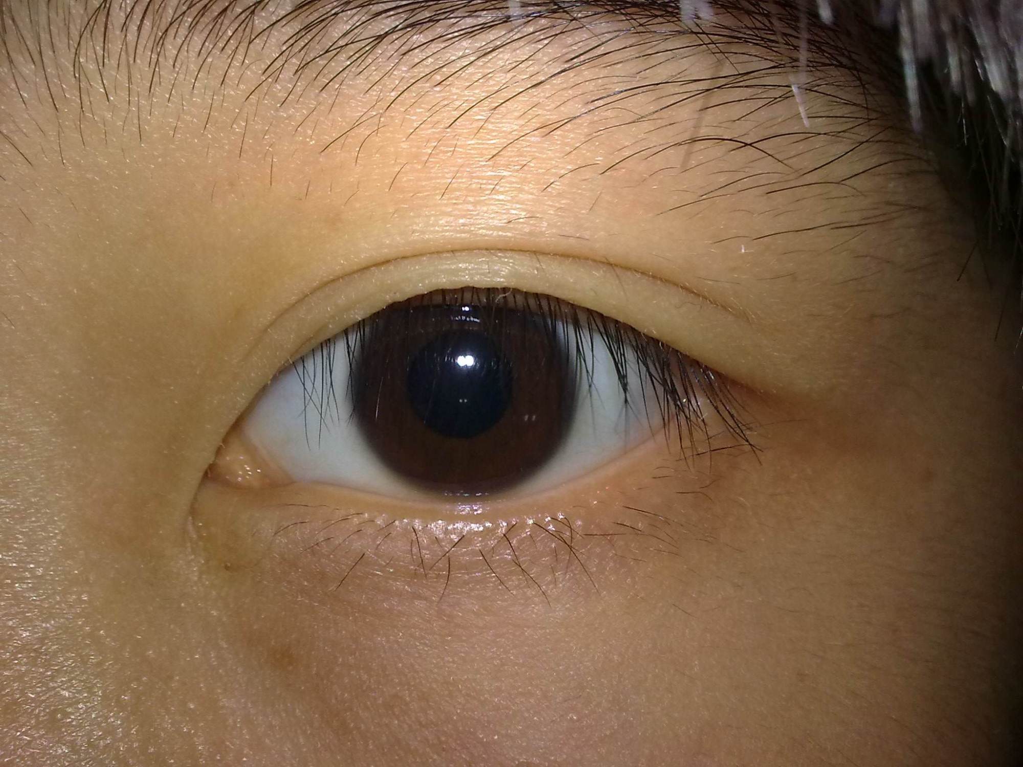 褐色瞳孔图片