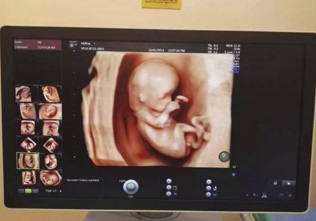 七个月胎儿头朝哪图片图片