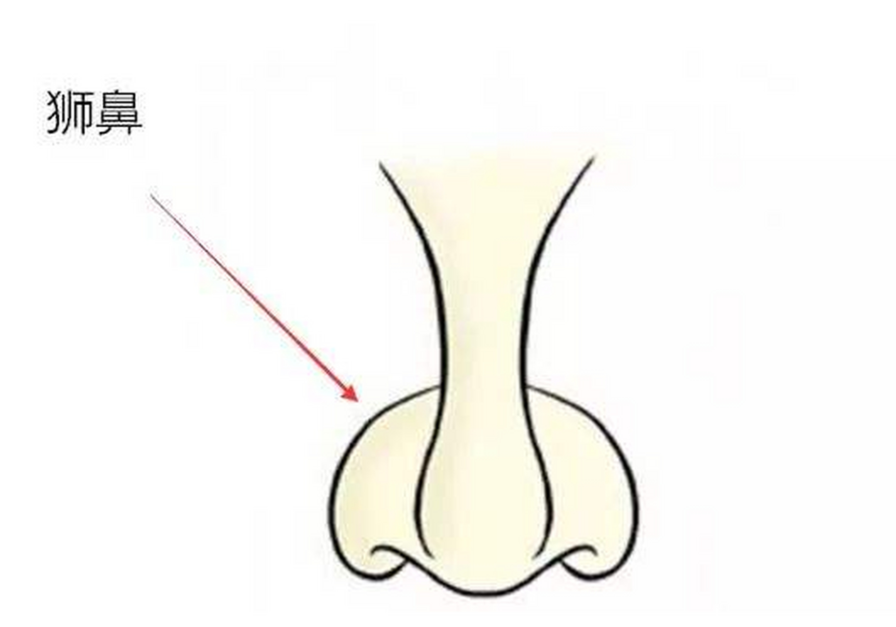这样的鼻子就是狮鼻.长有狮鼻的人精力充沛,是勤奋的实干家.