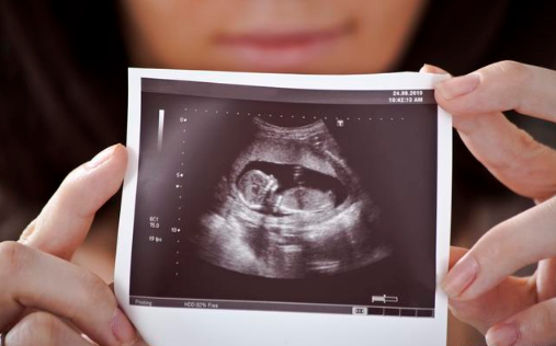 十一周的胎儿有多大图片