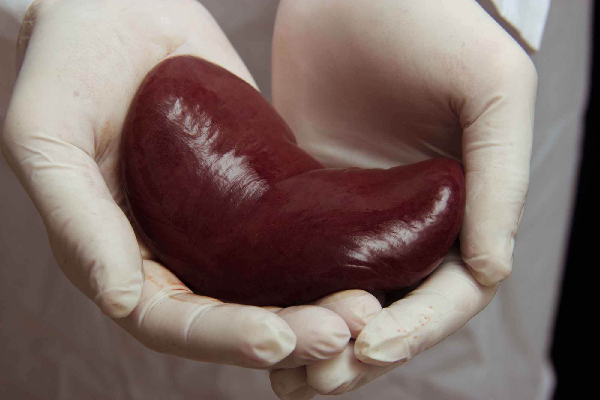 肾不好的原因有哪些?提醒:4个表现早知悉,警惕发病