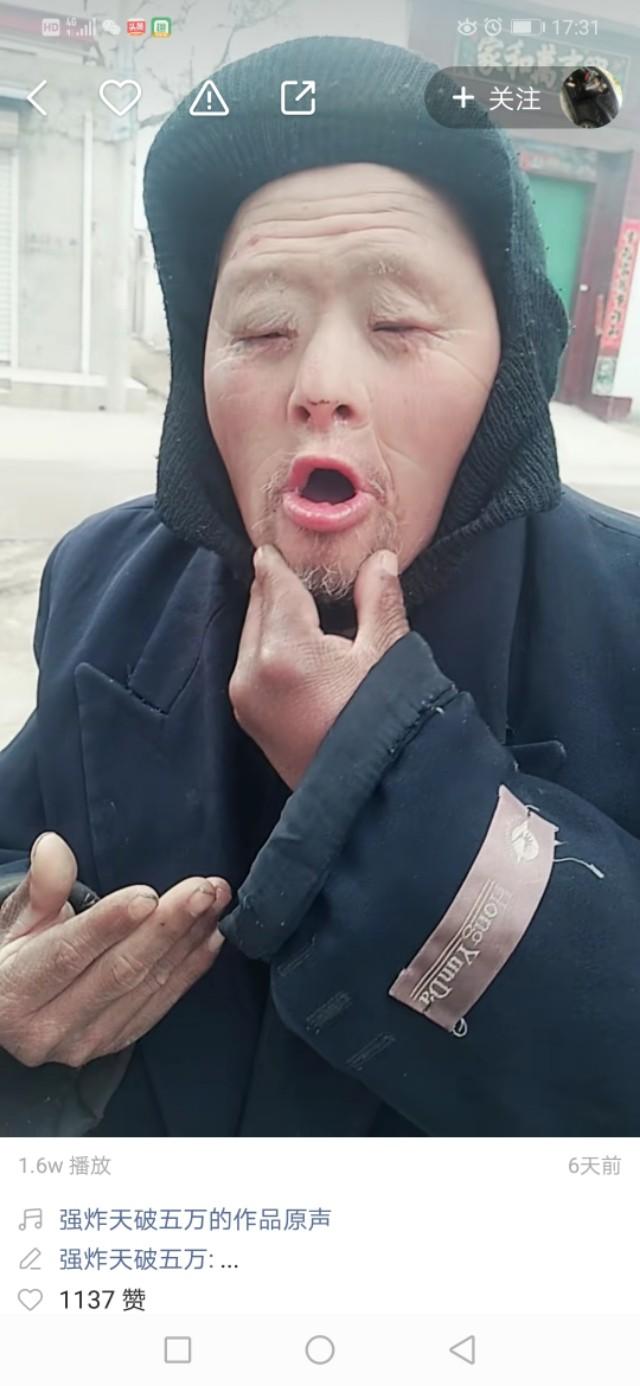 神奇:老大爷五官能随意扭曲,鼻子和嘴巴融为一体,网友:震惊!