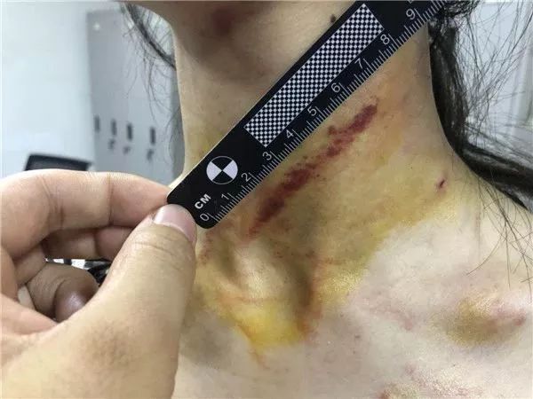 21岁姐姐被剪刀抵住脖子,拼命向后座的11岁妹妹喊:快跑,去喊救命