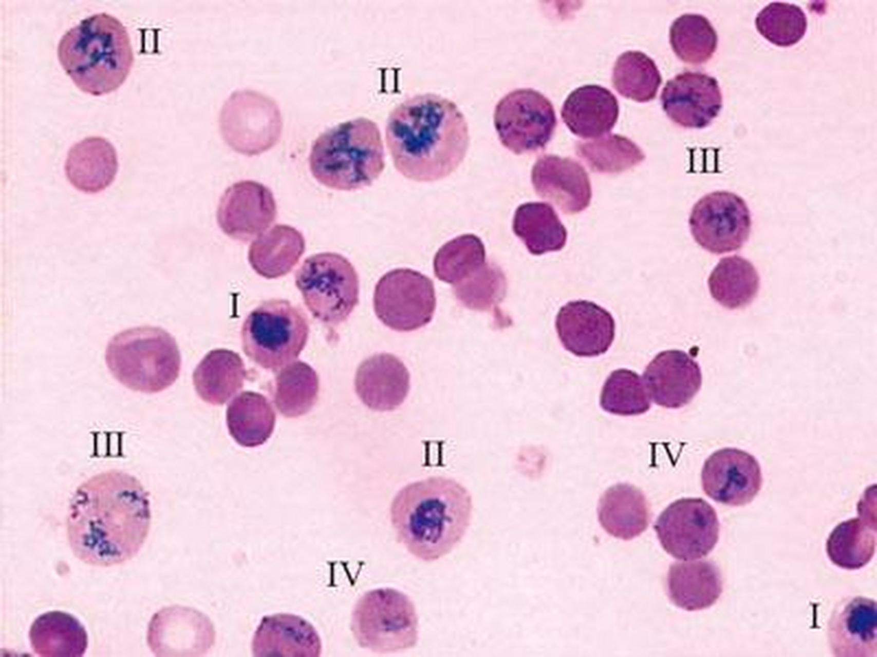 科普知识竞赛#网织红细胞是晚幼红细胞到完全成熟的红细胞之间的过渡
