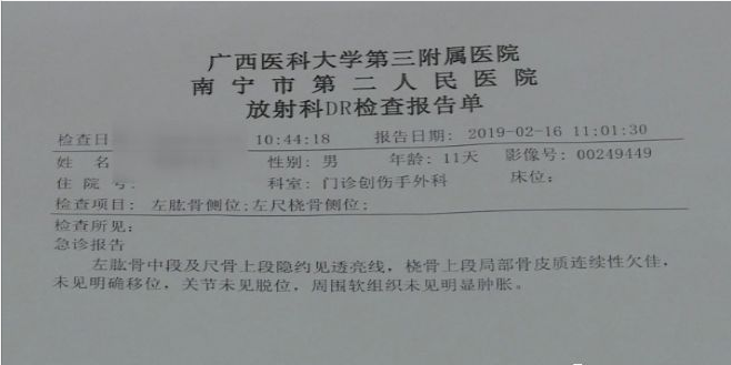 手臂骨折报告图片