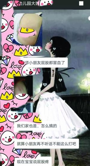 15名幼儿没午睡,小屁屁被老师打肿