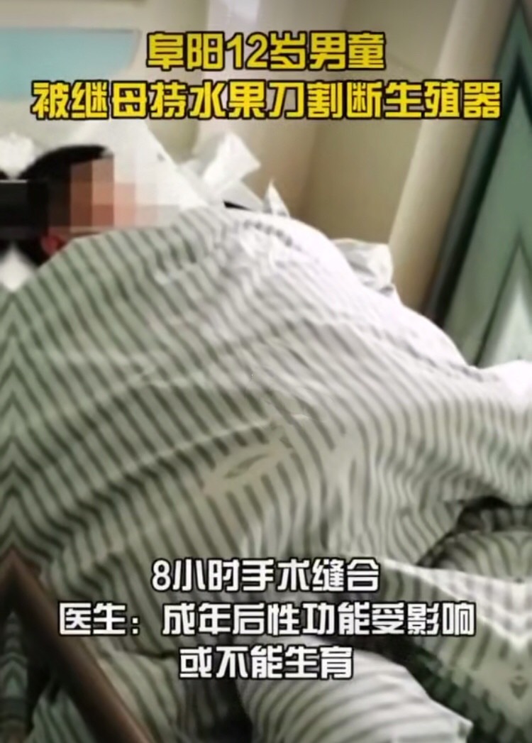12岁男童生殖器被继母割断,父亲:她有精神病,刚出院2月