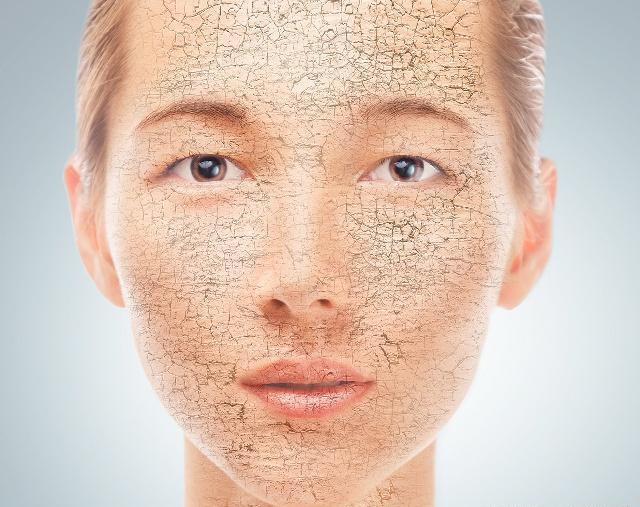 不弄明白这四点,拼命补水只会越补越干!