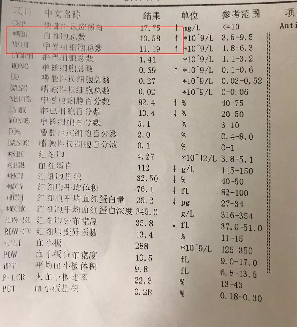 宝宝感冒发烧时,血常规能查出什么?专家帮你先睹为快