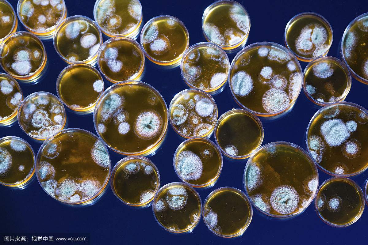 发酵传播者说目前的趋势可能会阻止我们的"疯狂的细菌恐惧症"