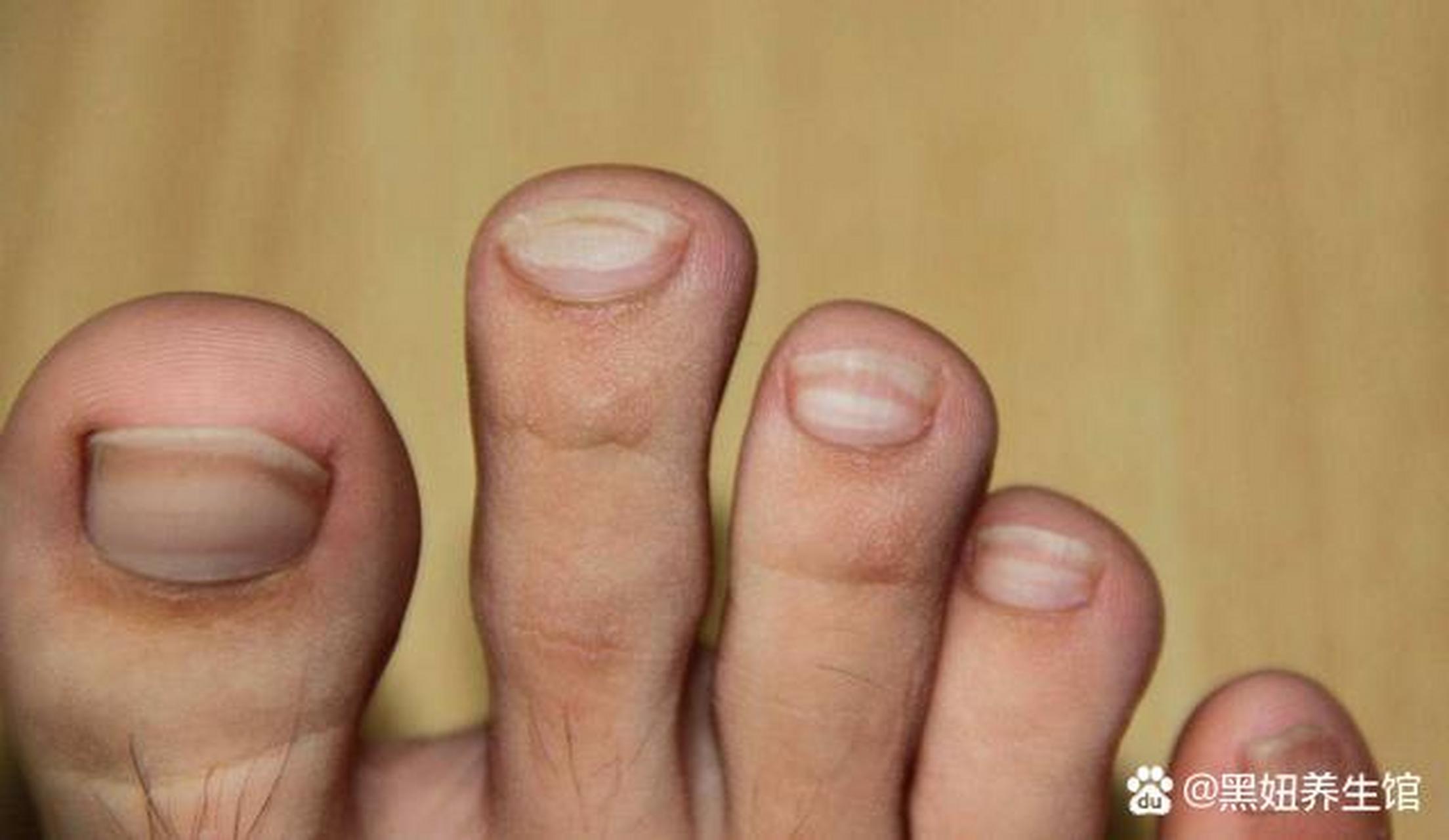 黑妞养生馆,养生早知道  身体好不好,脚先知道,3个脚部健康信号都占了